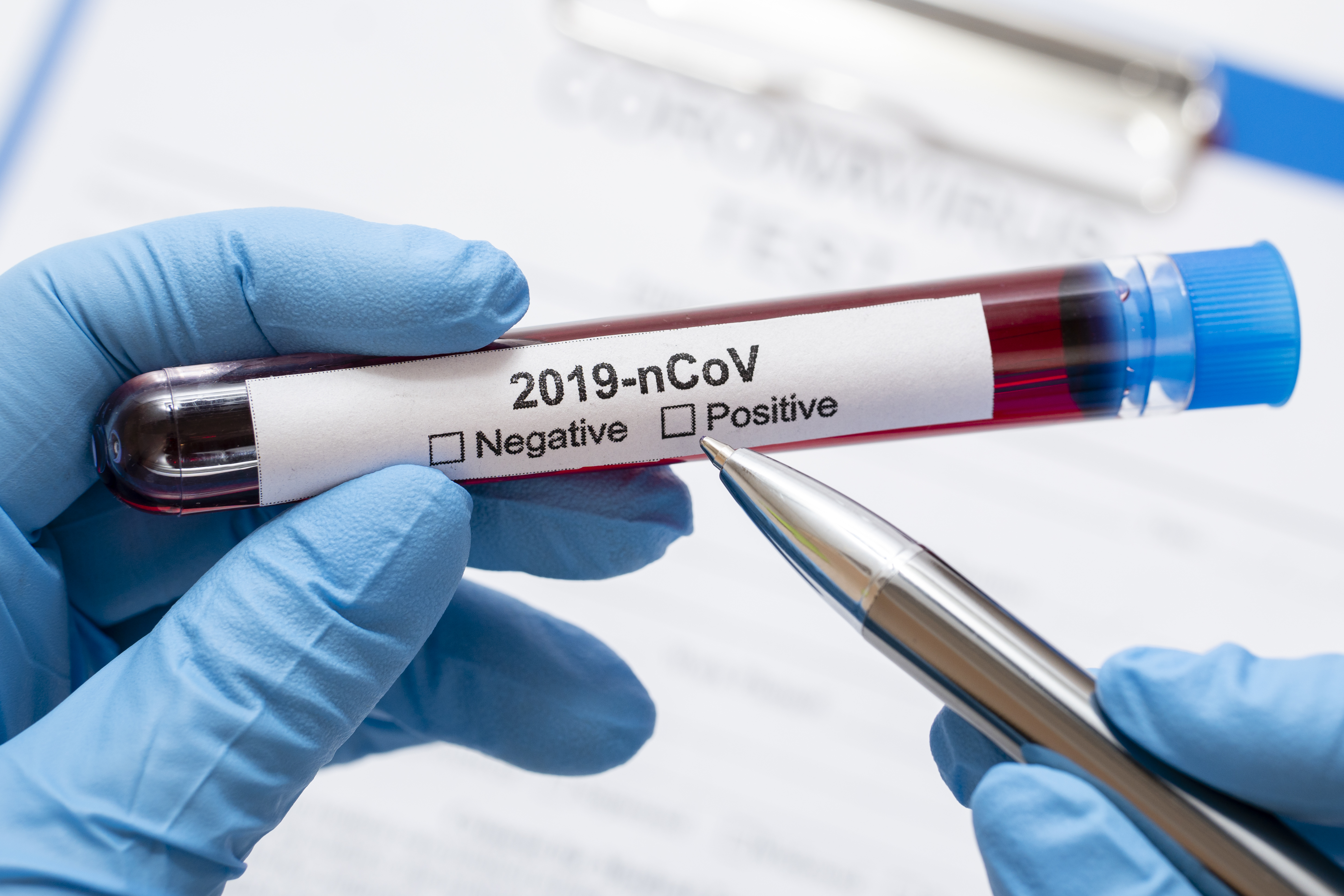 Koronavírus: 141 új megbetegedés országos szinten